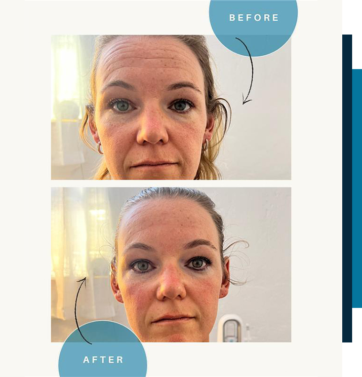 Custom Facials